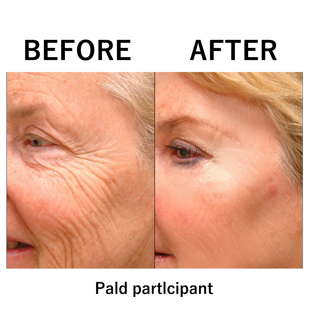 🎄🔥 Christmas Sale:Instant Temporary Face Tightener– 87% OFF! 🎅 Last Day Discount at the Official Brand Store!