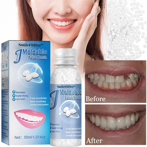 𦷠SmileFitPro⢠Dental Filling Gel ā Pain-Free, Drill-Free Cavity Solutionšš