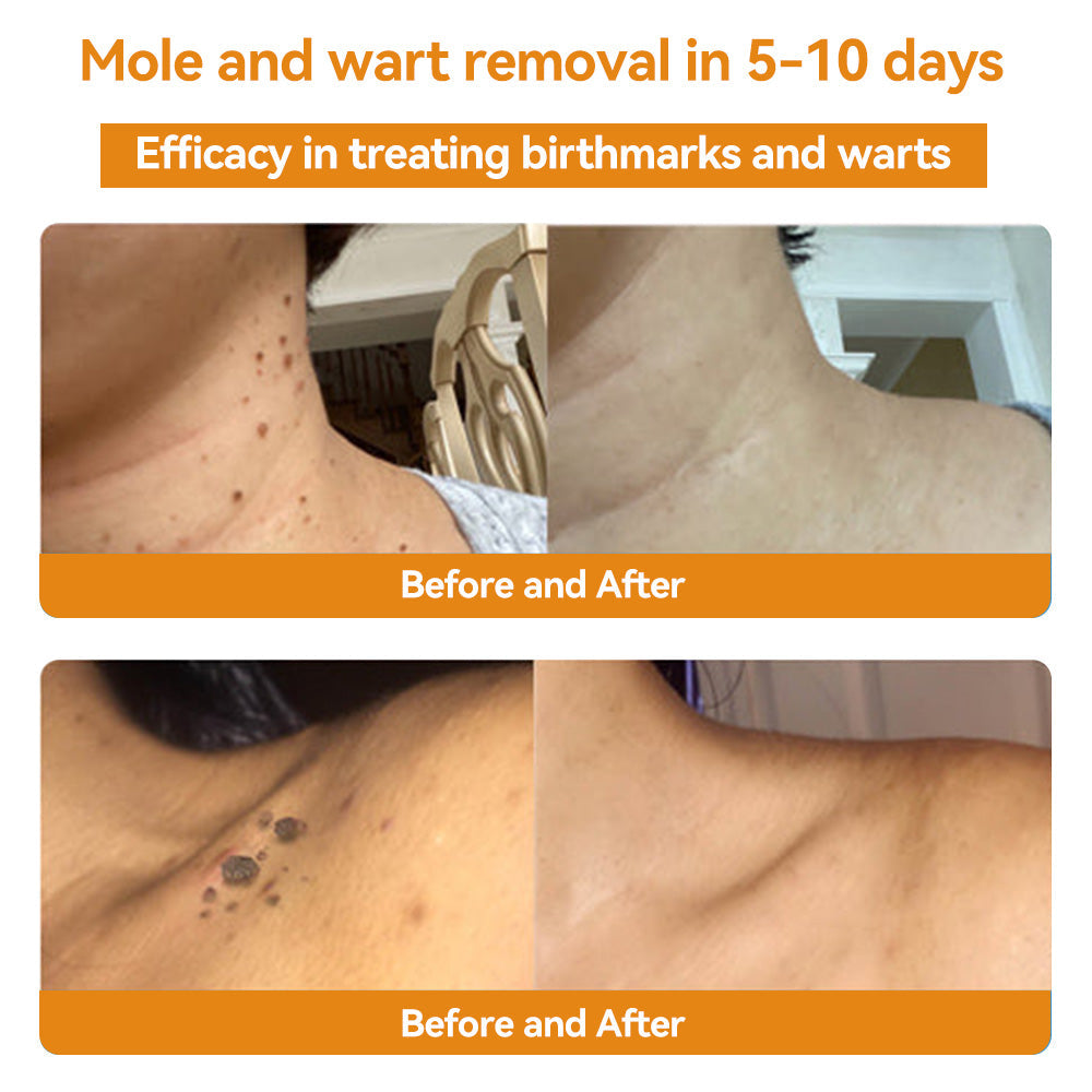 Lovildsβ’ Bee Venom Skin Treatment CreamοΌπ΄π΄π· π
πππππππππποΌ