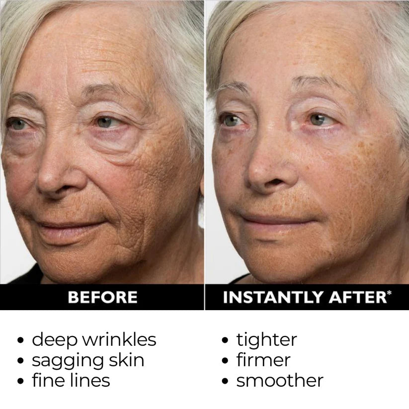 🎄🔥 Christmas Sale:Instant Temporary Face Tightener– 87% OFF! 🎅 Last Day Discount at the Official Brand Store!