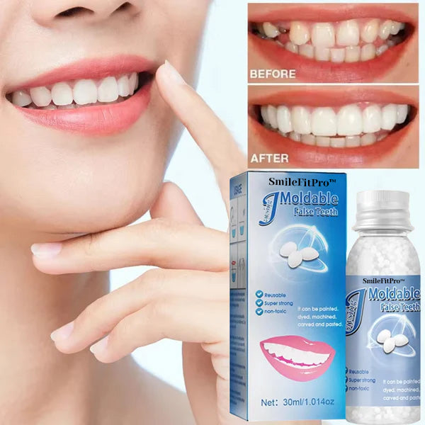 𦷠SmileFitPro⢠Dental Filling Gel ā Pain-Free, Drill-Free Cavity Solutionšš