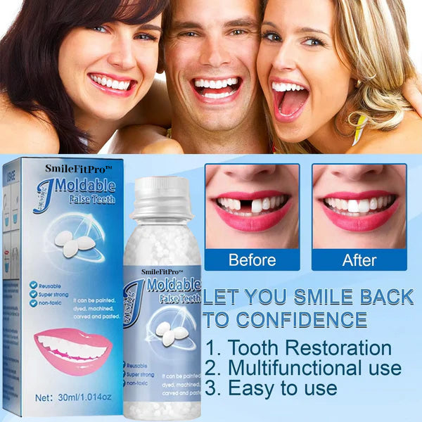 𦷠SmileFitPro⢠Dental Filling Gel ā Pain-Free, Drill-Free Cavity Solutionšš