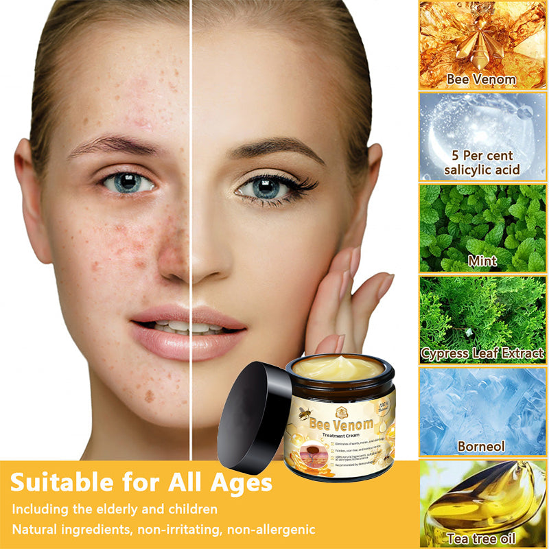 Lovildsβ’ Bee Venom Skin Treatment CreamοΌπ΄π΄π· π
πππππππππποΌ