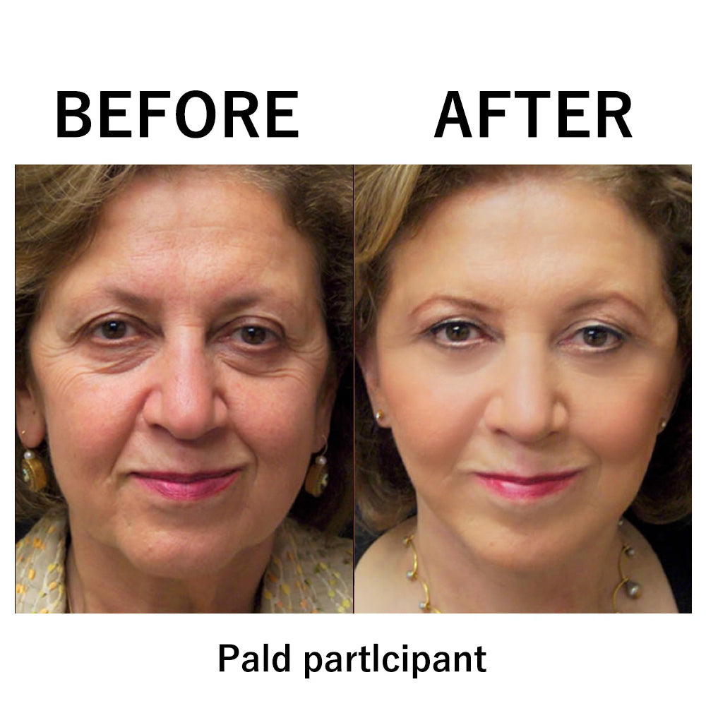 🎄🔥 Christmas Sale:Instant Temporary Face Tightener– 87% OFF! 🎅 Last Day Discount at the Official Brand Store!