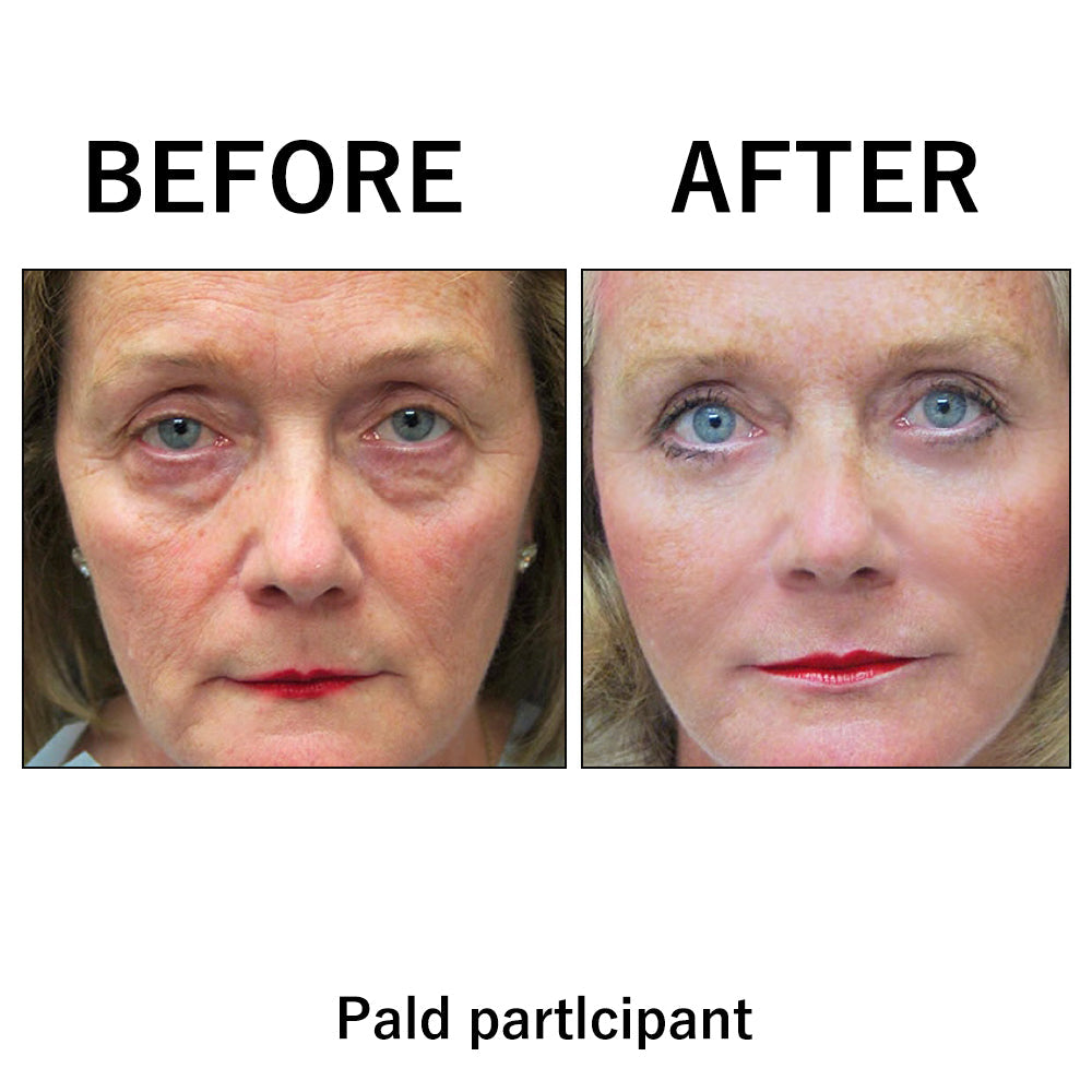 🎄🔥 Christmas Sale:Instant Temporary Face Tightener– 87% OFF! 🎅 Last Day Discount at the Official Brand Store!