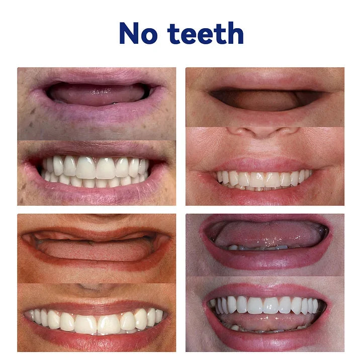 NESLEMY™🦷Advanced Customized Full Denture Set🦷 (⏰Limited time discount last 30 minutes⏰)
