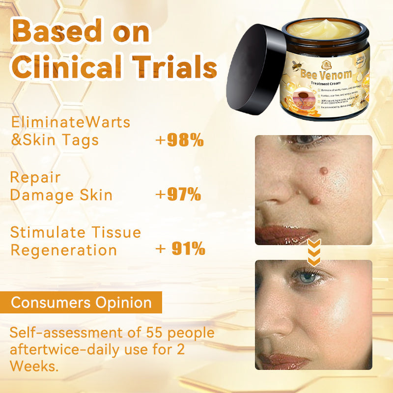 Lovildsβ’ Bee Venom Skin Treatment CreamοΌπ΄π΄π· π
πππππππππποΌ