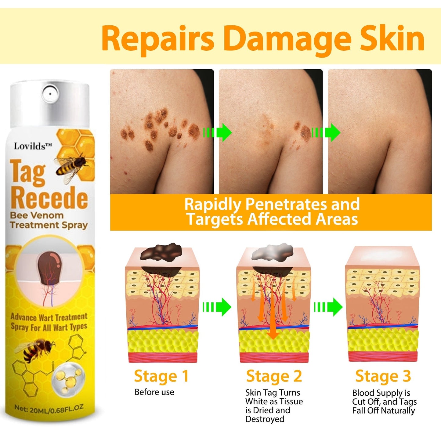 šLOVILDS⢠Tag Recede Bee Venom Treatment Spray