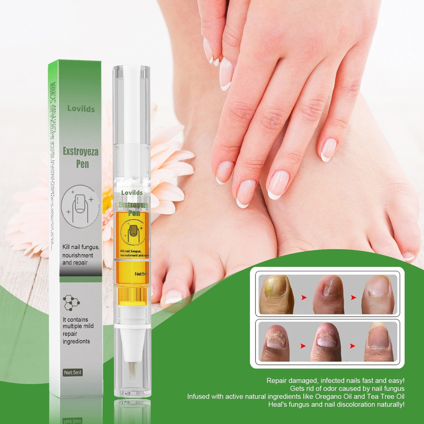 Anti-Fungal Pen – Gets Rid Of Even the Most Stubborn Nail Fungus