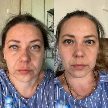 Japan Vision Drops — Rapidly Heals All Eye Conditions & Restores Vision