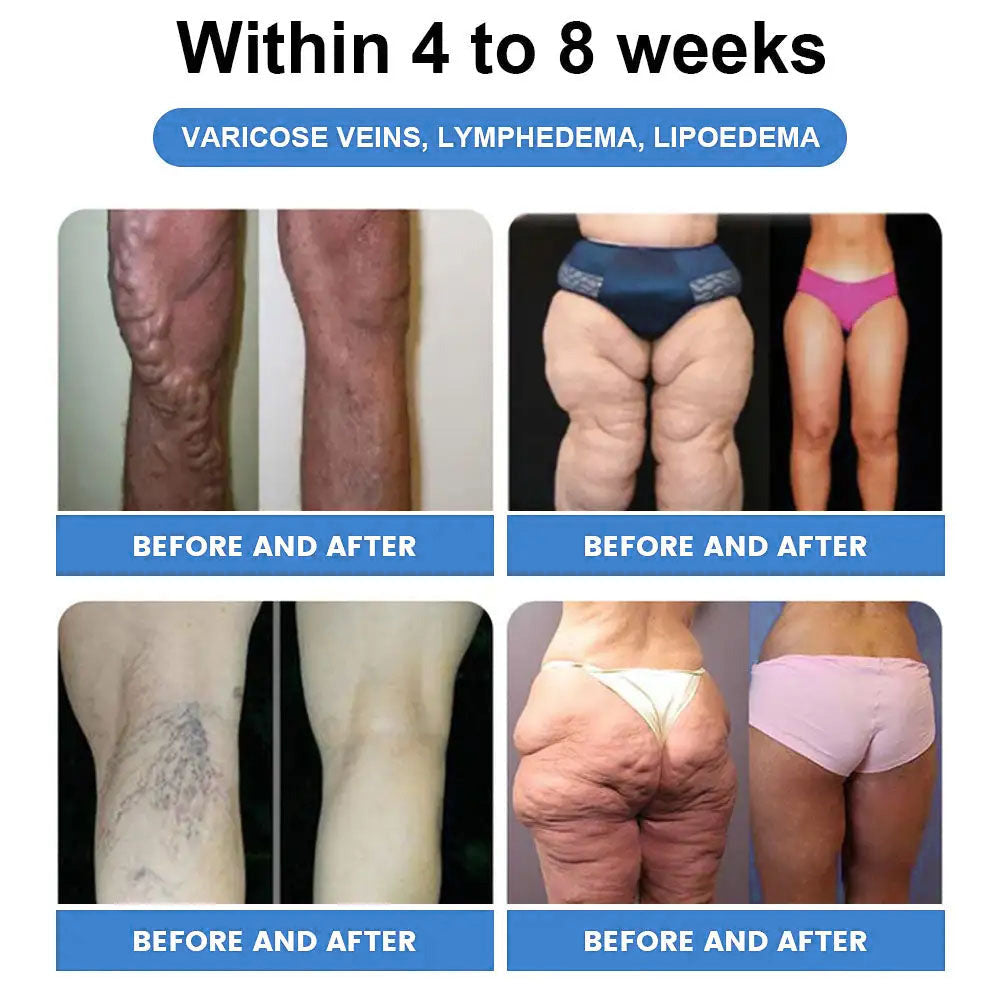 𝑀𝑎𝑦𝑜 𝐶𝑙𝑖𝑛𝑖𝑐 𝑅𝑒𝑐𝑜𝑚𝑚𝑒𝑛𝑑𝑒𝑑 | 𝑂𝑓𝑓𝑖𝑐𝑖𝑎𝑙 𝑆𝑡𝑜𝑟𝑒 | Cheemex® 𝐺𝐿𝑃-1  𝑊𝑒𝑖𝑔ℎ𝑡 𝐿𝑜𝑠𝑠 𝑂𝑟𝑎𝑙 𝑆𝑜𝑙𝑢𝑡𝑖𝑜𝑛 - 👨‍⚕️𝑂𝑏𝑒𝑠𝑖𝑡𝑦,𝐶𝑎𝑟𝑑𝑖𝑜𝑣𝑎𝑠𝑐𝑢𝑙𝑎𝑟 𝐷𝑖𝑠𝑒𝑎𝑠, 𝐷𝑖𝑎𝑏𝑒𝑡𝑒𝑠, 𝑆𝑙𝑒𝑒𝑝 𝐴𝑝𝑛𝑒𝑎, 𝐽𝑜𝑖𝑛𝑡 𝑃𝑟𝑜𝑏𝑙𝑒𝑚𝑠 𝑎𝑛𝑑 𝑀𝑜𝑟𝑒