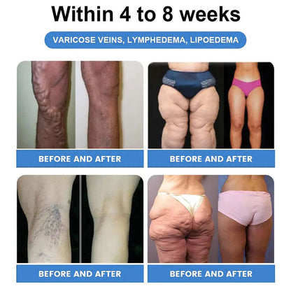 𝑀𝑎𝑦𝑜 𝐶𝑙𝑖𝑛𝑖𝑐 𝑅𝑒𝑐𝑜𝑚𝑚𝑒𝑛𝑑𝑒𝑑 | 𝑂𝑓𝑓𝑖𝑐𝑖𝑎𝑙 𝑆𝑡𝑜𝑟𝑒 | Cheemex® 𝐺𝐿𝑃-1  𝑊𝑒𝑖𝑔ℎ𝑡 𝐿𝑜𝑠𝑠 𝑂𝑟𝑎𝑙 𝑆𝑜𝑙𝑢𝑡𝑖𝑜𝑛 - 👨‍⚕️𝑂𝑏𝑒𝑠𝑖𝑡𝑦,𝐶𝑎𝑟𝑑𝑖𝑜𝑣𝑎𝑠𝑐𝑢𝑙𝑎𝑟 𝐷𝑖𝑠𝑒𝑎𝑠, 𝐷𝑖𝑎𝑏𝑒𝑡𝑒𝑠, 𝑆𝑙𝑒𝑒𝑝 𝐴𝑝𝑛𝑒𝑎, 𝐽𝑜𝑖𝑛𝑡 𝑃𝑟𝑜𝑏𝑙𝑒𝑚𝑠 𝑎𝑛𝑑 𝑀𝑜𝑟𝑒