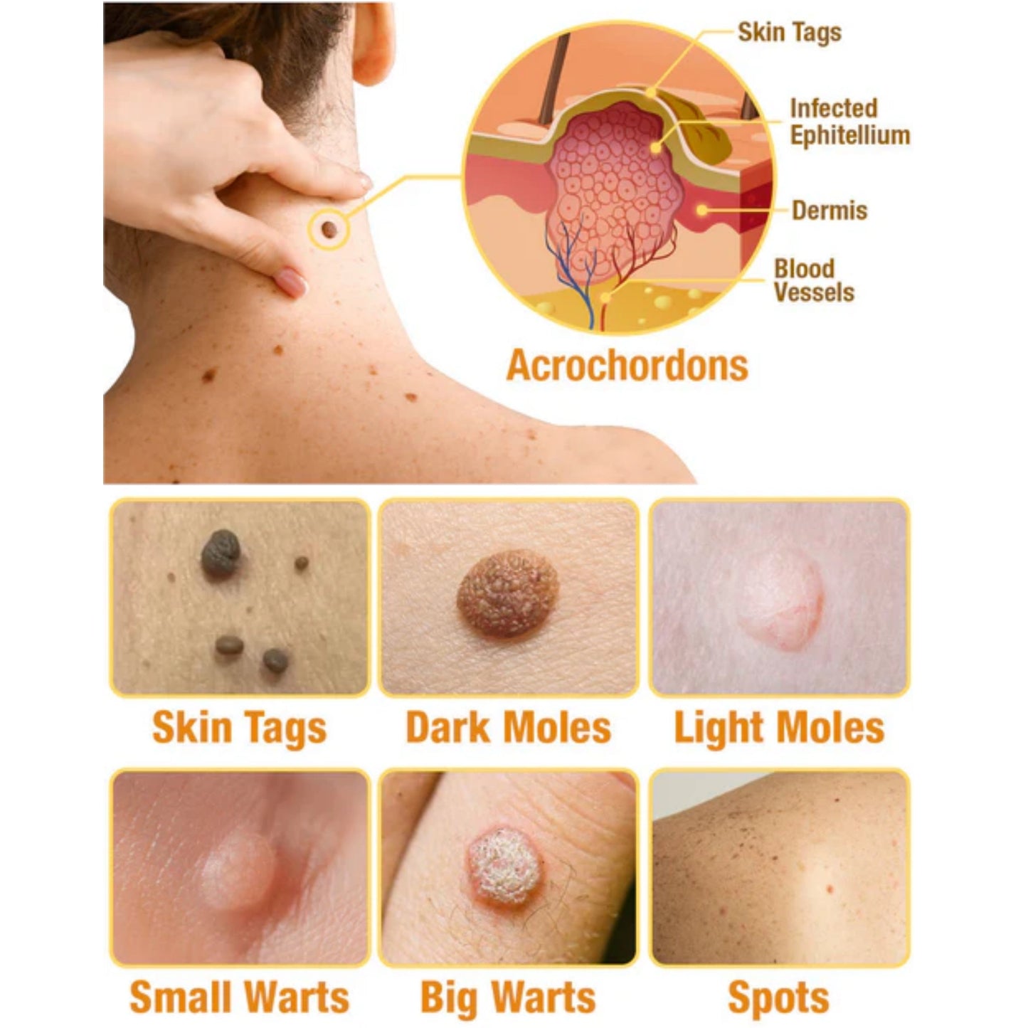 🐝LOVILDS™ Tag Recede Bee Venom Treatment Spray
