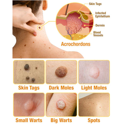 🐝LOVILDS™ Tag Recede Bee Venom Treatment Spray