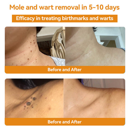 Lovilds™ Bee Venom Skin Treatment Cream（𝐴𝐴𝐷 𝑅𝑒𝑐𝑜𝑚𝑚𝑒𝑛𝑑𝑒𝑑）