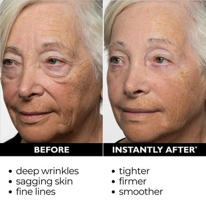 🎄🔥 Christmas Sale:Instant Temporary Face Tightener– 87% OFF! 🎅 Last Day Discount at the Official Brand Store!