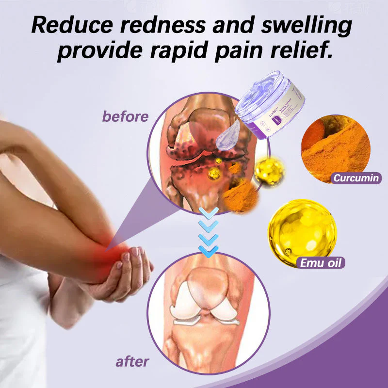 Joint Pain Treatment Gel