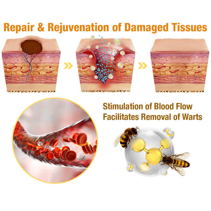 🐝LOVILDS™ Tag Recede Bee Venom Treatment Spray